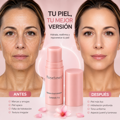 Rosetimes™ Balsamo Facial Hidratante Antiarrugas